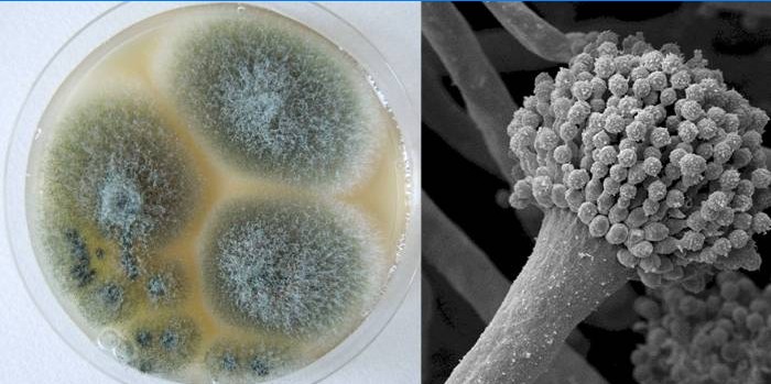 Aspergillus fumigatus