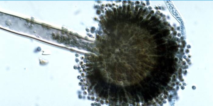 Aspergillus niger