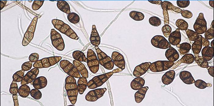 Propagácia húb Alternaria alternata