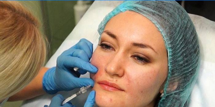 Žena dostáva injekcie do nasolabiálnych záhybov