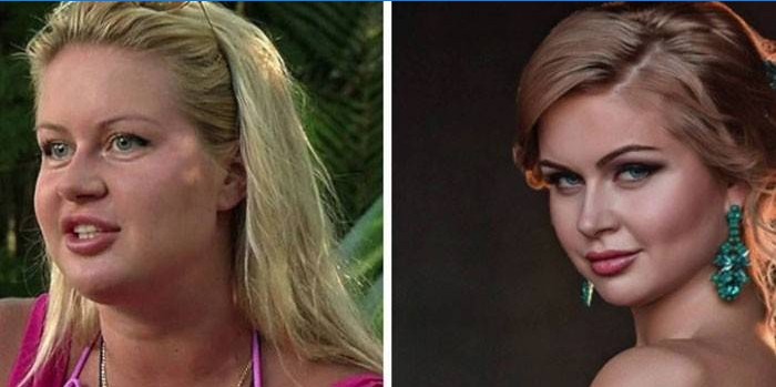Afrikantova je tučná a riedka